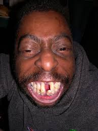 crackhead.jpg