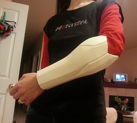 forearm-cast-1.jpg